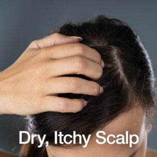 Scalp Problems Treatments