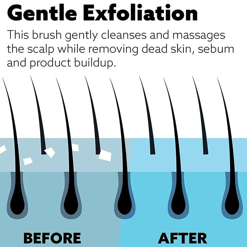 WetBrush Head Start Exfoliating Scalp Massager - Image 10