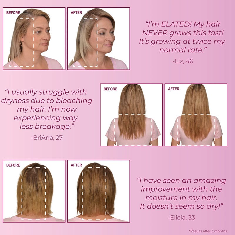 Bosley MD MendXtend Strengthening Conditioner - Image 5