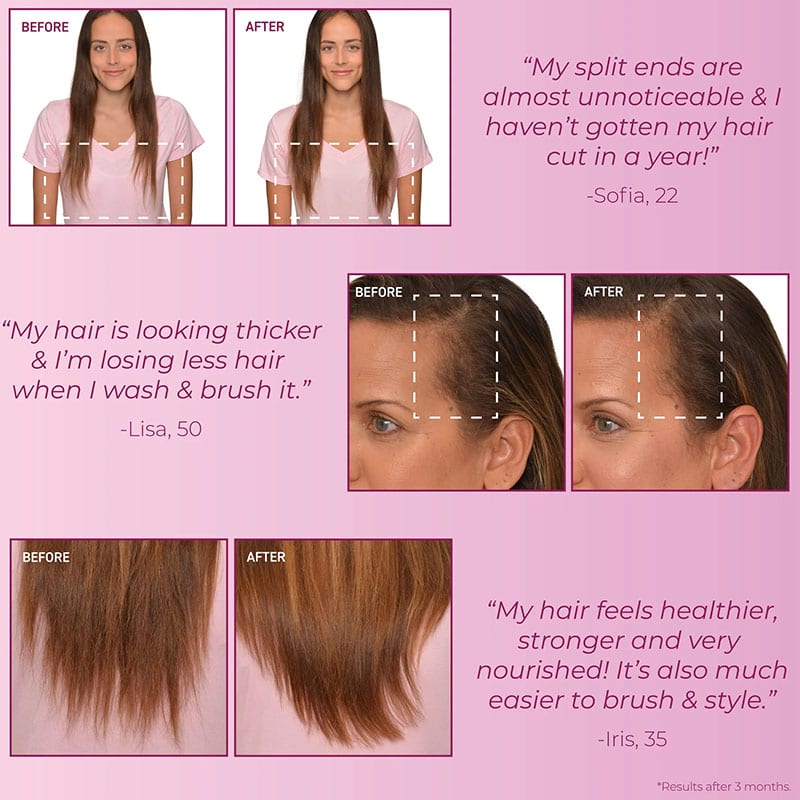 Bosley MD MendXtend Strengthening Conditioner - Image 7